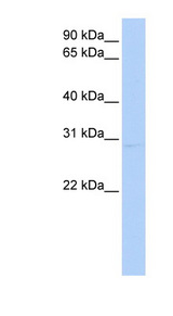 KCNIP2 / KCHIP2 Antibody - KCNIP2 / KCHIP2 antibody Western blot of HeLa lysate. This image was taken for the unconjugated form of this product. Other forms have not been tested.