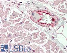 KCNIP2 / KCHIP2 Antibody - Human Heart: Formalin-Fixed, Paraffin-Embedded (FFPE).  This image was taken for the unconjugated form of this product. Other forms have not been tested.