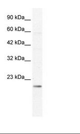 KCNIP2 / KCHIP2 Antibody - Jurkat Cell Lysate.  This image was taken for the unconjugated form of this product. Other forms have not been tested.