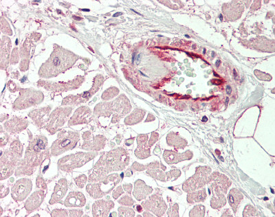 KCNIP2 / KCHIP2 Antibody - Human Heart: Formalin-Fixed, Paraffin-Embedded (FFPE).  This image was taken for the unconjugated form of this product. Other forms have not been tested.