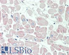 KCNIP2 / KCHIP2 Antibody - Human Heart: Formalin-Fixed, Paraffin-Embedded (FFPE).  This image was taken for the unconjugated form of this product. Other forms have not been tested.