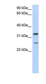 KCNIP2 / KCHIP2 Antibody - KCNIP2 / KCHIP2 antibody western blot of Jurkat cell lysate.  This image was taken for the unconjugated form of this product. Other forms have not been tested.