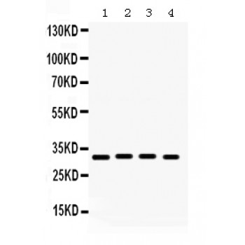 KCNIP2 / KCHIP2 Antibody - KCNIP2 antibody Western blot. All lanes: Anti KCNIP2 at 0.5 ug/ml. Lane 1: Rat Brain Tissue Lysate at 50 ug. Lane 2: Rat Cardiac Muscle Tissue Lysate at 50 ug. Lane 3: Mouse Cardiac Muscle Tissue Lysate at 50 ug. Lane 4: 22RV1 Whole Cell Lysate at 40 ug. Predicted band size: 31 kD. Observed band size: 31 kD.