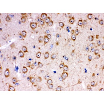 KCNIP2 / KCHIP2 Antibody - KCNIP2 antibody IHC-paraffin. IHC(P): Rat Brain Tissue.