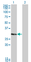 KCNIP2 / KCHIP2 Antibody - Western blot of KCNIP2 expression in transfected 293T cell line by KCNIP2 monoclonal antibody (M01), clone 3E7.