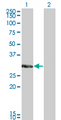 KCNIP2 / KCHIP2 Antibody - Western blot of KCNIP2 expression in transfected 293T cell line by KCNIP2 monoclonal antibody (M01), clone 3E7.