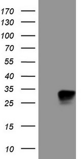 KCNIP2 / KCHIP2 Antibody - HEK293T cells were transfected with the pCMV6-ENTRY control (Left lane) or pCMV6-ENTRY KCNIP2 (Right lane) cDNA for 48 hrs and lysed. Equivalent amounts of cell lysates (5 ug per lane) were separated by SDS-PAGE and immunoblotted with anti-KCNIP2.