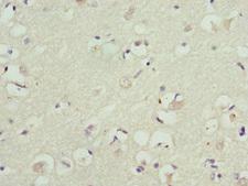 KCNIP2 / KCHIP2 Antibody - Immunohistochemistry of paraffin-embedded human brain tissue at dilution 1:100