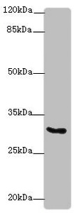 KCNIP2 / KCHIP2 Antibody - Western blot All Lanes: KCNIP2antibody at 4.58ug/ml+ Hela whole cell lysate Goat polyclonal to rabbit at 1/10000 dilution Predicted band size: 31,29,26,27,33,21,22 kDa Observed band size: 31 kDa