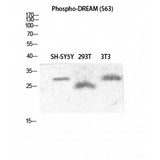 KCNIP3 / Dream / Calsenilin Antibody - Western blot of Phospho-DREAM (S63) antibody