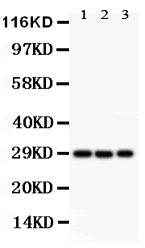 KCNIP3 / Dream / Calsenilin Antibody - Western blot - Anti-CSEN Antibody