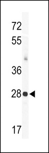 KCNIP3 / Dream / Calsenilin Antibody - Western blot of KChIP3 Antibody (N-term M1) in mouse heart tissue lysates (35 ug/lane). KChIP3(arrow) was detected using the purified antibody.