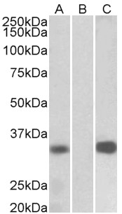 KCNIP3 / Dream / Calsenilin Antibody - KCNIP3 antibody HEK293 lysate (10 ug protein in RIPA buffer) overexpressing Human KCNIP3 with C-terminal MYC tag probed with (1 ug/ml) in Lane A and probed with anti-MYC Tag (1/1000) in lane C. Mock-transfected HEK293 probed with (1 mg/ml) in Lane B. Primary incubations were for 1 hour. Detected by chemiluminescence.