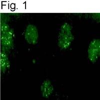 KCNIP3 / Dream / Calsenilin Antibody - KChIP3 Antibody in Immunofluorescence (IF)