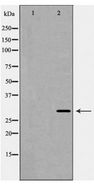 KCNIP3 / Dream / Calsenilin Antibody - Western blot of Calsenilin/KCNIP3 expression in A431 cells