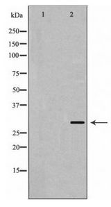 KCNIP3 / Dream / Calsenilin Antibody - Western blot of Calsenilin/KCNIP3 expression in A431 cells
