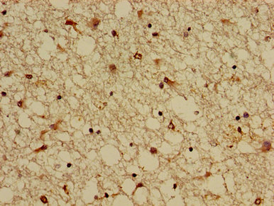 KCNIP3 / Dream / Calsenilin Antibody - Immunohistochemistry image of paraffin-embedded human brain tissue at a dilution of 1:100