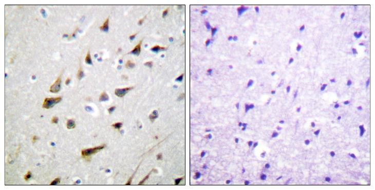 KCNIP3 / Dream / Calsenilin Antibody - Peptide - + Immunohistochemistry analysis of paraffin-embedded human brain tissue using Calsenilin/KCNIP3 (Ab-63) antibody.