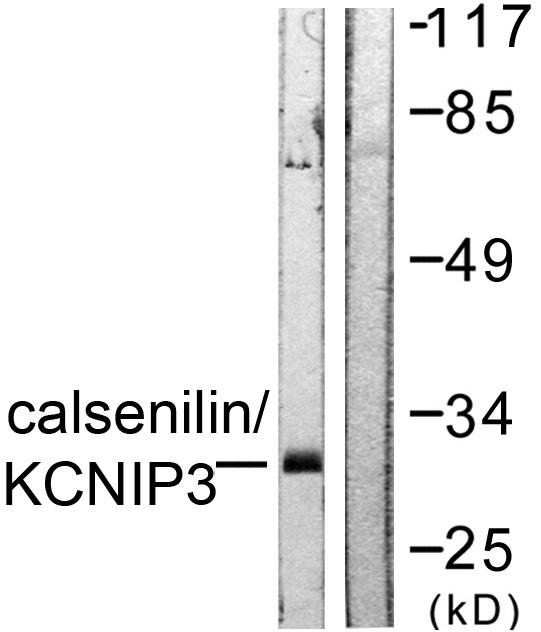 KCNIP3 / Dream / Calsenilin Antibody - Western blot analysis of extracts from A431 cells, using Calsenilin/KCNIP3 (Ab-63) antibody.