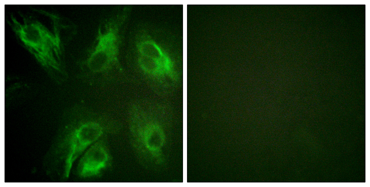 KCNIP3 / Dream / Calsenilin Antibody - Immunofluorescence analysis of HeLa cells, using Calsenilin/KCNIP3 (Phospho-Ser63) Antibody. The picture on the right is blocked with the phospho peptide.