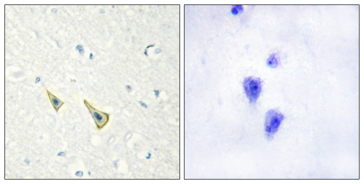 KCNIP3 / Dream / Calsenilin Antibody - Immunohistochemistry analysis of paraffin-embedded human brain, using Calsenilin/KCNIP3 (Phospho-Ser63) Antibody. The picture on the right is blocked with the phospho peptide.
