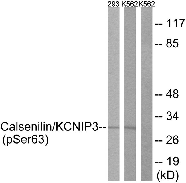 KCNIP3 / Dream / Calsenilin Antibody - Western blot analysis of lysates from K562 cells treated with forskolin 40nM 30' and 293 cells treated with PMA 125ng/ml 30', using Calsenilin/KCNIP3 (Phospho-Ser63) Antibody. The lane on the right is blocked with the phospho peptide.