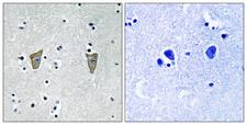 KCNIP3 / Dream / Calsenilin Antibody - P-peptide - + Immunohistochemistry analysis of paraffin-embedded human brain tissue using Calsenilin/KCNIP3 (Phospho-Ser63) antibody.
