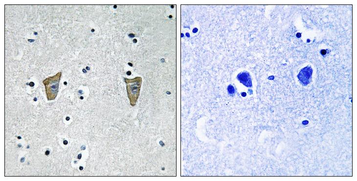 KCNIP3 / Dream / Calsenilin Antibody - P-peptide - + Immunohistochemistry analysis of paraffin-embedded human brain tissue using Calsenilin/KCNIP3 (Phospho-Ser63) antibody.