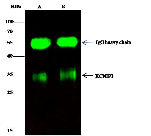 KCNIP3 / Dream / Calsenilin Antibody - KCNIP3 was immunoprecipitated using: Lane A: 0.5 mg MCF-7 Whole Cell Lysate. Lane B: 0.5 mg THP-1 Whole Cell Lysate. 0.5 uL anti-KCNIP3 rabbit polyclonal antibody and 15 ul of 50% Protein G agarose. Primary antibody: Anti-KCNIP3 rabbit polyclonal antibody, at 1:350 dilution. Secondary antibody: Dylight 800-labeled antibody to rabbit IgG (H+L), at 1:5000 dilution. Developed using the odssey technique. Performed under reducing conditions. Predicted band size: 28 kDa. Observed band size: 35 kDa.