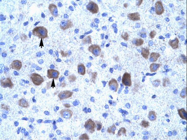 KCNIP4 / KCHIP4 Antibody - Human Brain.  This image was taken for the unconjugated form of this product. Other forms have not been tested.