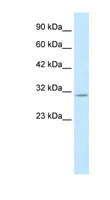 KCNIP4 / KCHIP4 Antibody - KCNIP4 antibody Western blot of Jurkat lysate. This image was taken for the unconjugated form of this product. Other forms have not been tested.