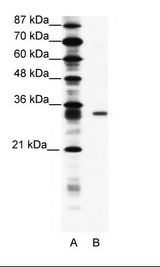 KCNIP4 / KCHIP4 Antibody - A: Marker, B: Jurkat Cell Lysate.  This image was taken for the unconjugated form of this product. Other forms have not been tested.