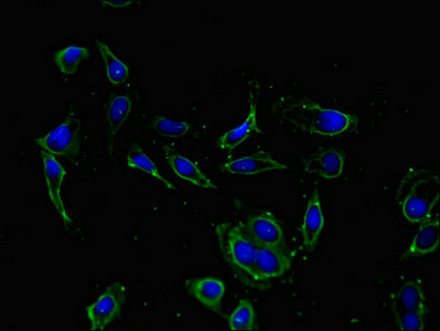 KCNIP4 / KCHIP4 Antibody - Immunofluorescent analysis of Hela cells using KCNIP4 Antibody at dilution of 1:100 and Alexa Fluor 488-congugated AffiniPure Goat Anti-Rabbit IgG(H+L)