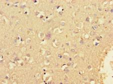 KCNIP4 / KCHIP4 Antibody - Immunohistochemistry of paraffin-embedded human brain tissue using KCNIP4 Antibody at dilution of 1:100