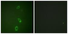 KCNJ1 / ROMK Antibody - Immunofluorescence analysis of A549 cells, using ROMK/Kir1.1 Antibody. The picture on the right is blocked with the synthesized peptide.