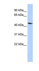 KCNJ1 / ROMK Antibody - KCNJ1 / Kir1.1 antibody Western blot of HepG2 cell lysate. This image was taken for the unconjugated form of this product. Other forms have not been tested.
