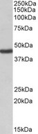 KCNJ1 / ROMK Antibody - KCNJ1 / ROMK antibody (1µg/ml) staining of Human Kidney lysate (35µg protein in RIPA buffer). Primary incubation was 1 hour. Detected by chemiluminescence.