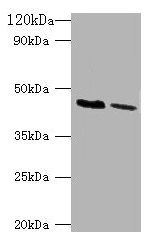 KCNJ1 / ROMK Antibody - Western blot All lanes: ATP-sensitive inward rectifier potassium channel 1 antibody at 2µg/ml Lane 1: HepG2 whole cell lysate Lane 2: Hela whole cell lysate Secondary Goat polyclonal to rabbit IgG at 1/10000 dilution Predicted band size: 45, 43 kDa Observed band size: 45 kDa