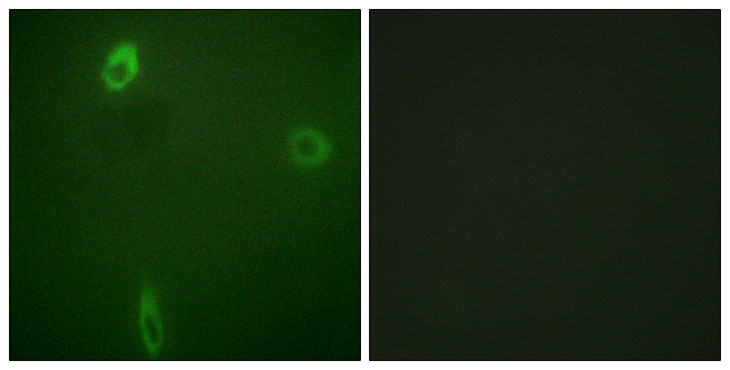 KCNJ1 / ROMK Antibody - Immunofluorescence analysis of A549 cells, using ROMK/Kir1.1 (Phospho-Ser44/25) Antibody. The picture on the right is blocked with the phospho peptide.