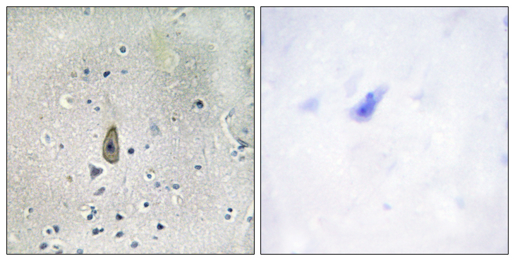 KCNJ1 / ROMK Antibody - Immunohistochemistry analysis of paraffin-embedded human brain, using ROMK/Kir1.1 (Phospho-Ser44/25) Antibody. The picture on the right is blocked with the phospho peptide.