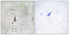 KCNJ1 / ROMK Antibody - Immunohistochemistry analysis of paraffin-embedded human brain, using ROMK/Kir1.1 (Phospho-Ser44/25) Antibody. The picture on the right is blocked with the phospho peptide.