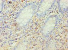 KCNJ10 / SESAME / KIR4.1 Antibody - Immunohistochemistry of paraffin-embedded human epityphlon tissue using antibody at 1:100 dilution.  This image was taken for the unconjugated form of this product. Other forms have not been tested.