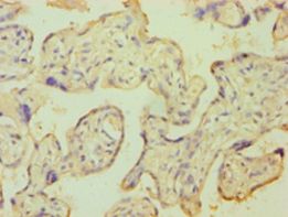KCNJ10 / SESAME / KIR4.1 Antibody - Immunohistochemistry of paraffin-embedded human placenta tissue using antibody at 1:100 dilution.  This image was taken for the unconjugated form of this product. Other forms have not been tested.