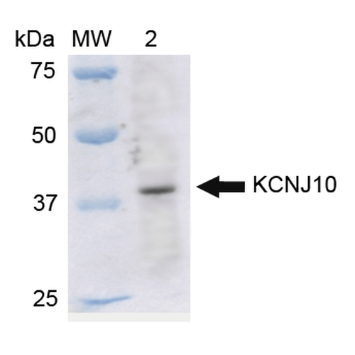 KCNJ10 / SESAME / KIR4.1 Antibody - Western blot analysis of Rat Liver cell lysates showing detection of ~42.5 kDa Kir4.1 protein using Rabbit Anti-Kir4.1 Polyclonal Antibody. Lane 1: Molecular Weight Ladder (MW). Lane 2: Rat Liver cell lysates. Load: 15 µg. Block: 5% Skim Milk in 1X TBST. Primary Antibody: Rabbit Anti-Kir4.1 Polyclonal Antibody  at 1:1000 for 2 hours at RT. Secondary Antibody: Goat Anti-Rabbit IgG: HRP at 1:2000 for 60 min at RT. Color Development: ECL solution for 6 min in RT. Predicted/Observed Size: ~42.5 kDa.