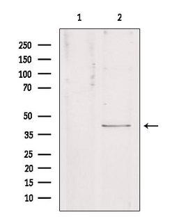 KCNJ10 / SESAME / KIR4.1 Antibody - Western blot analysis of extracts of HeLa cells using KCNJ10 antibody. Lane 1 was treated with the blocking peptide.