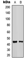 KCNJ11 / Kir6.2 Antibody - Western blot analysis of Kir6.2 expression in HeLa (A); NIH3T3 (B) whole cell lysates.