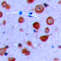 KCNJ11 / Kir6.2 Antibody - Immunohistochemical analysis of Kir6.2 staining in human brain cortex formalin fixed paraffin embedded tissue section. The section was pre-treated using heat mediated antigen retrieval with sodium citrate buffer (pH 6.0). The section was then incubated with the antibody at room temperature and detected using an HRP conjugated compact polymer system. DAB was used as the chromogen. The section was then counterstained with hematoxylin and mounted with DPX.
