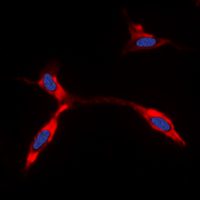 KCNJ11 / Kir6.2 Antibody - Immunofluorescent analysis of Kir6.2 staining in HeLa cells. Formalin-fixed cells were permeabilized with 0.1% Triton X-100 in TBS for 5-10 minutes and blocked with 3% BSA-PBS for 30 minutes at room temperature. Cells were probed with the primary antibody in 3% BSA-PBS and incubated overnight at 4 deg C in a humidified chamber. Cells were washed with PBST and incubated with a DyLight 594-conjugated secondary antibody (red) in PBS at room temperature in the dark. DAPI was used to stain the cell nuclei (blue).