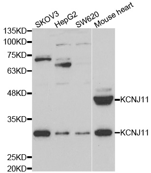 KCNJ11 / Kir6.2 Antibody - Western blot analysis of extracts of various cell lines.