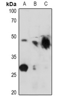 KCNJ11 / Kir6.2 Antibody - Western blot analysis of Kir6.2 (pT224) expression in MCF7 (A), mouse liver (B), rat liver (C) whole cell lysates.